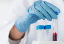 Pięć nowych potwierdzonych przypadków zarażenia koronawirusem