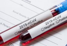 Sanepid Głogów.  W ostatniej dobie 6 przypadków zdiagnozowanych – 3 kobiety i 3 mężczyzn